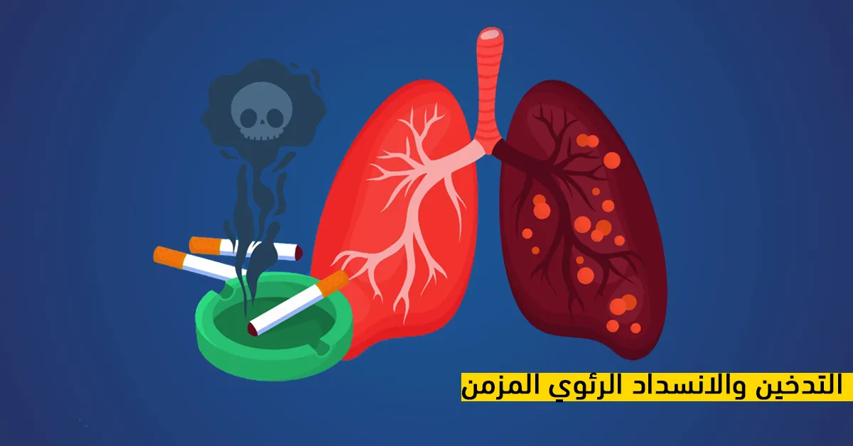 التدخين والانسداد الرئوي المزمن